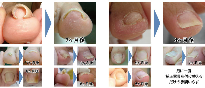 ペディグラステクノロジー ｜ 施術を受けたい方