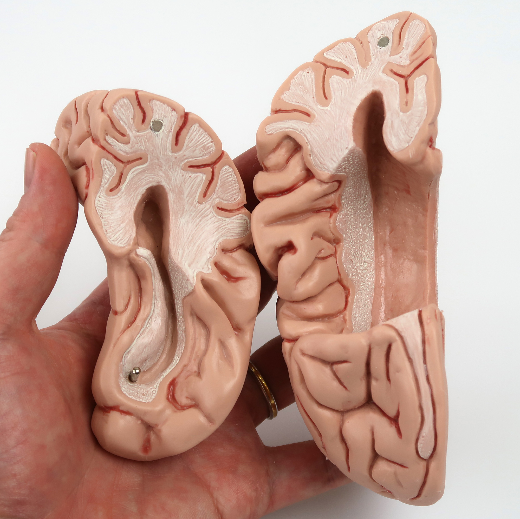 脳，5分解モデル | 日本スリービー・サイエンティフィック