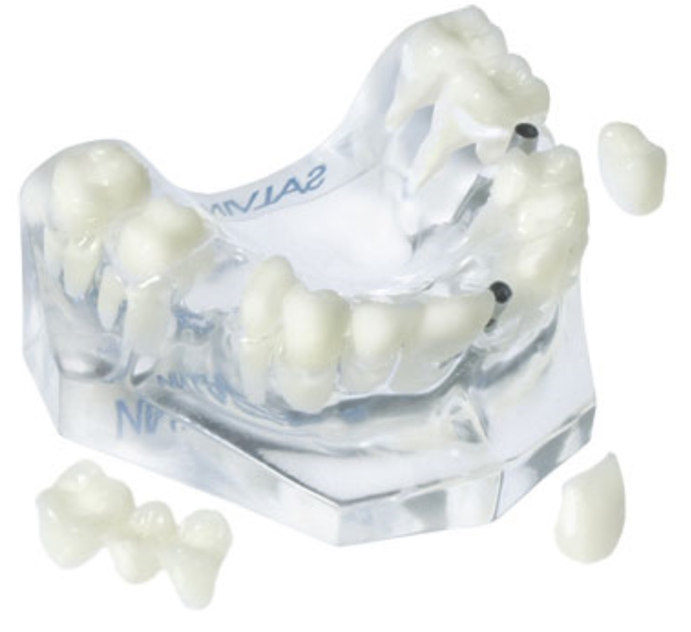 株式会社インプラテックスの取扱い商品「患者説明・治療管理・実習