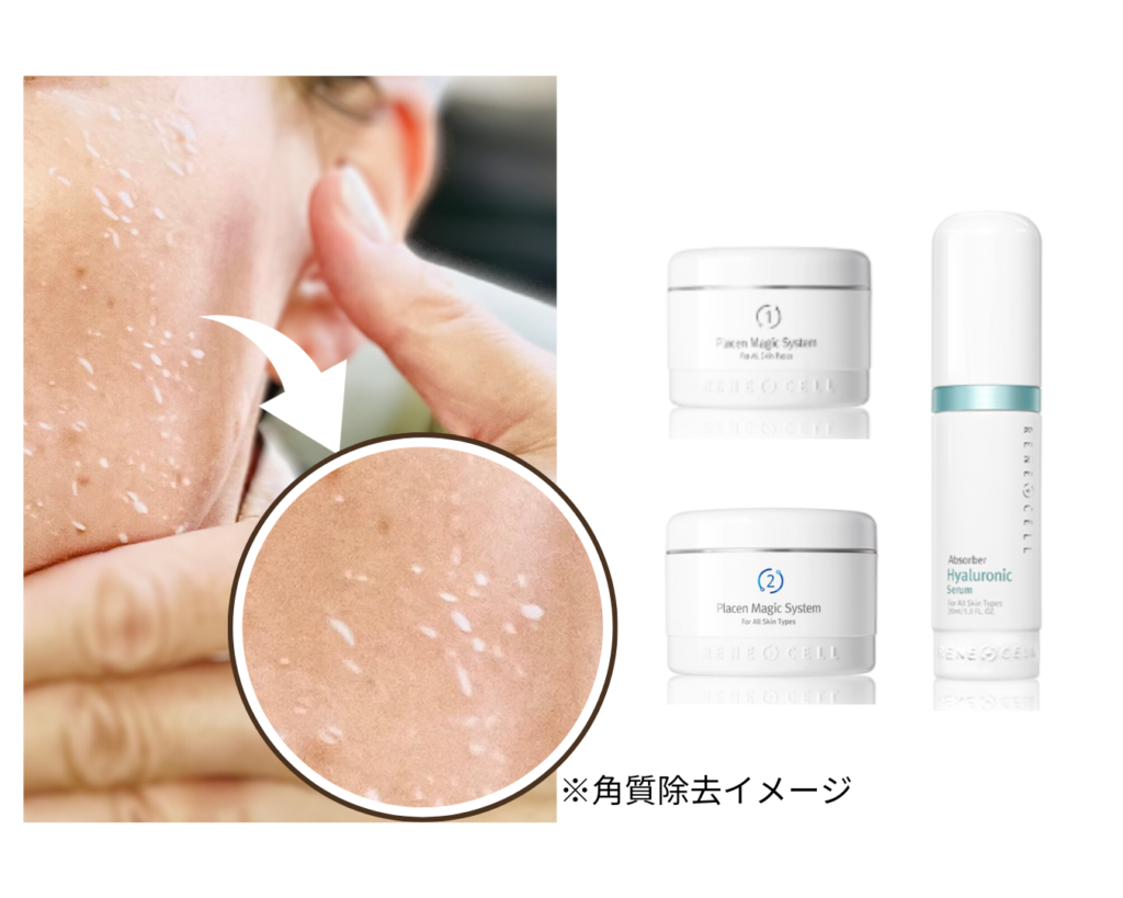 ルネセル化粧品のご購入 – Facial Salon Vihara