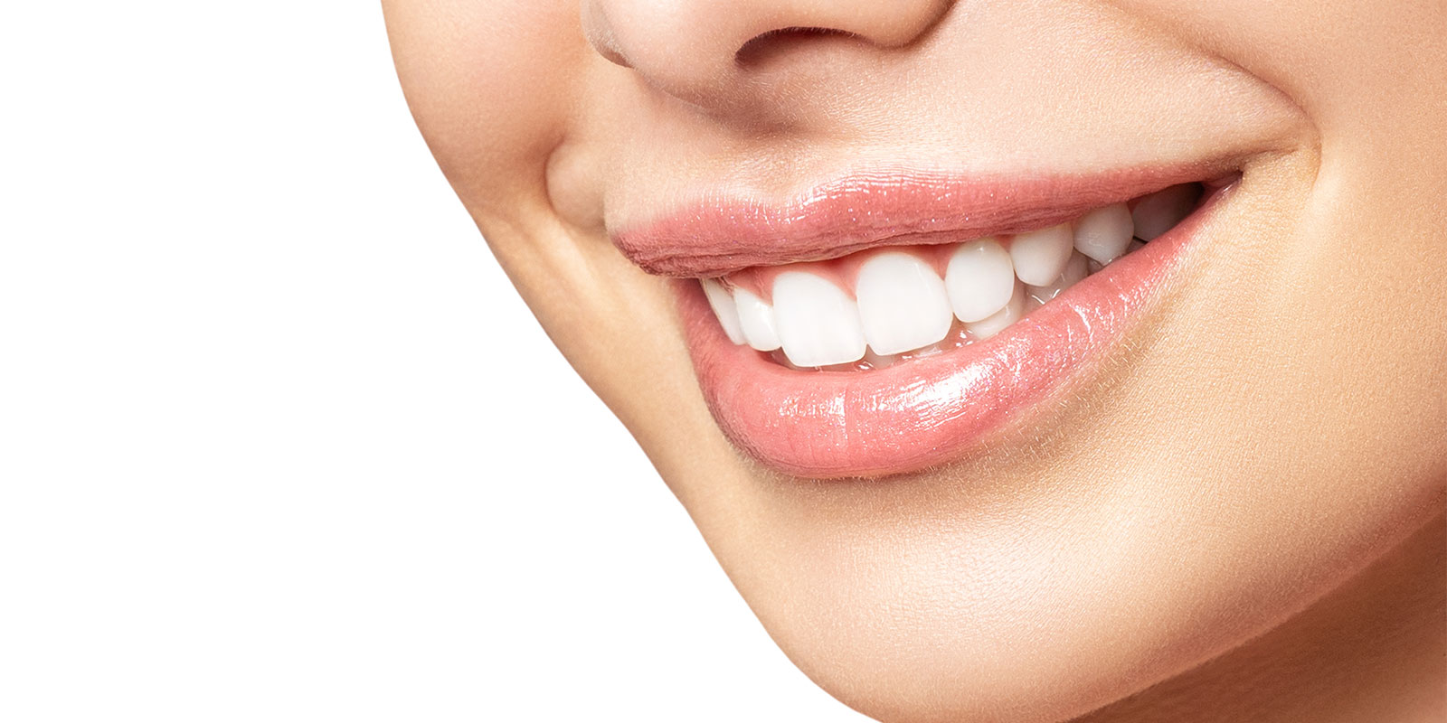 マウスピース矯正の加速装置って？| 横浜・町田のマウスピース矯正は