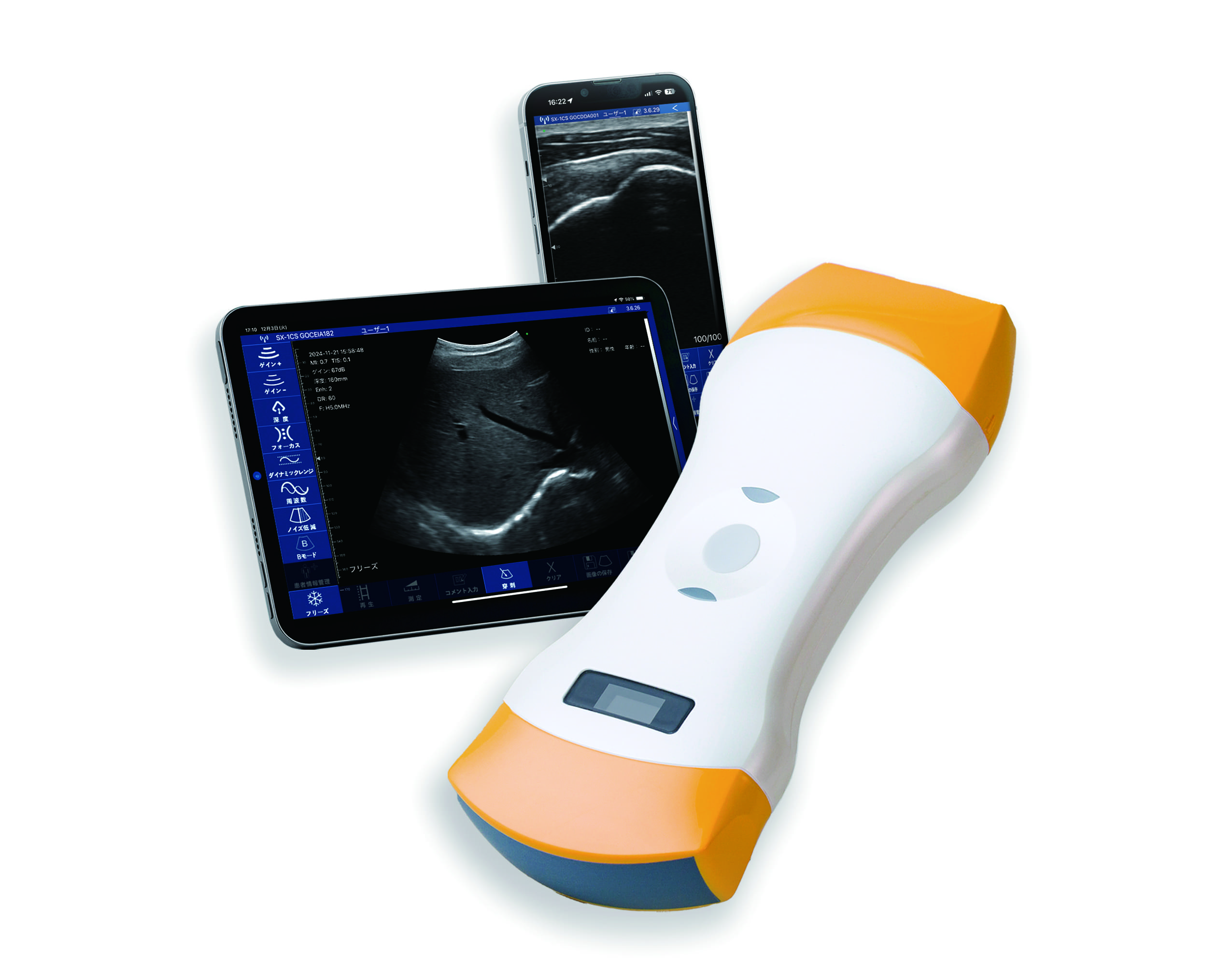 超音波画像診断装置「ポケットエコーmiruco CL5」製品情報 | 日本シグ