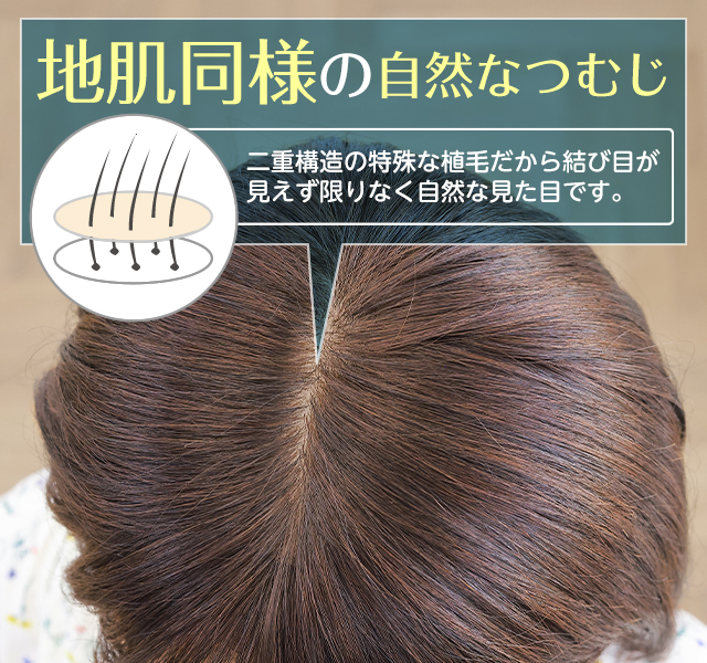 医療用ウィッグレミー｜レミープレミアム【フロントレース