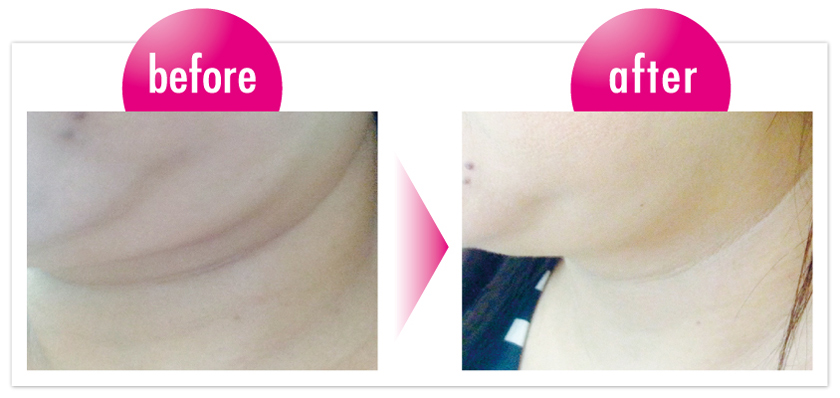 トロワボウテ ネック&デコ クワトロストレッチングクリーム 50g/80g