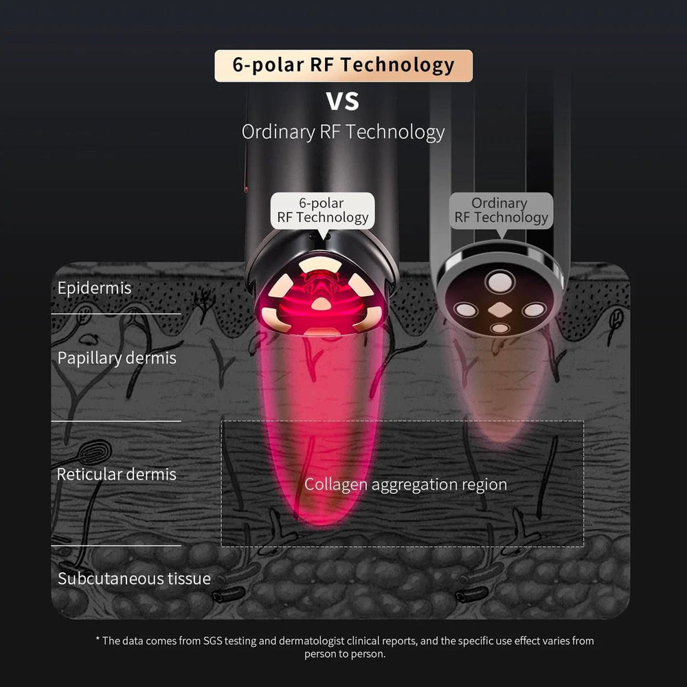 AMIRO R1 PRO Facial RF Skin Tightening Device – Beauty Foo Mall (M