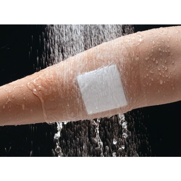 アルケア マルチフィックス・ロール 10号（100mm×長さ10m） 17823 1巻