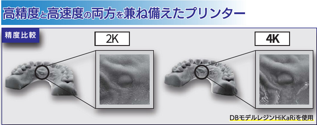 DB Phrozen 3Dプリンター4K SONIC XL DENTAL – 株式会社日本歯科商社