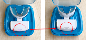 光加速装置（オルソパルス） ｜ 名古屋駅から10分の矯正歯科｜名古屋西