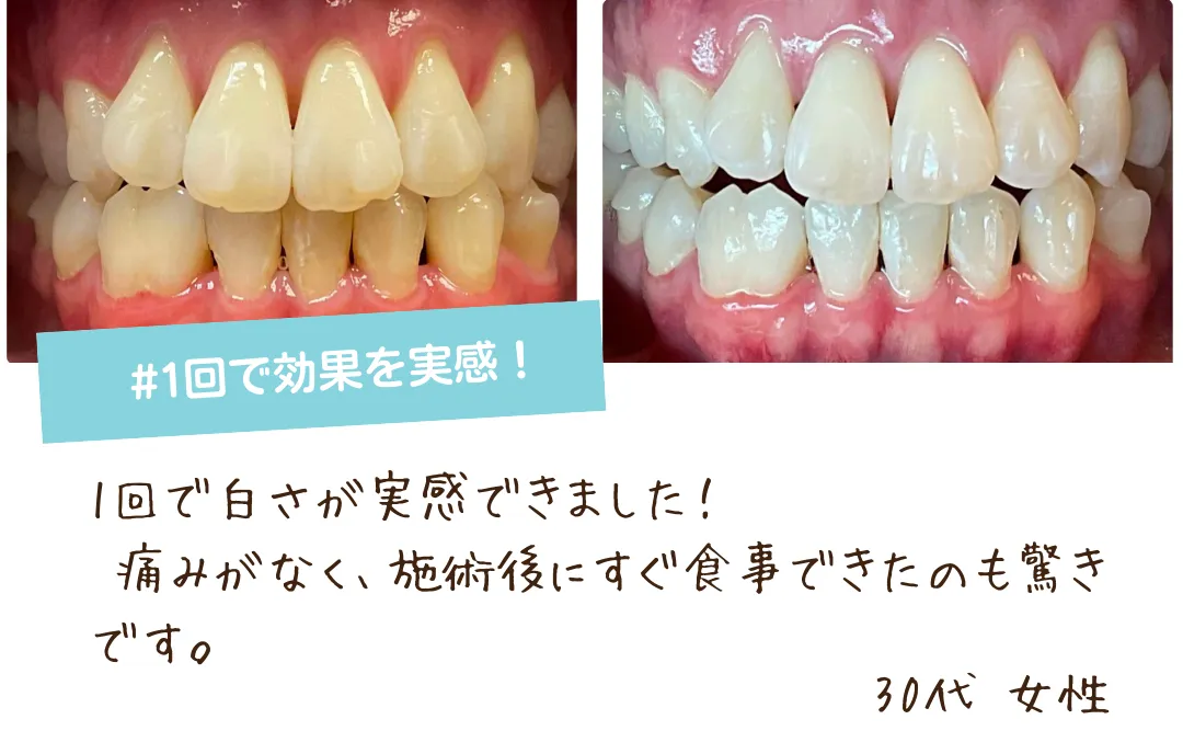 京橋駅1分セルフホワイトニング｜ホノルルホワイトニング京橋店