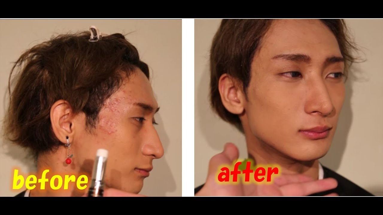 肌トラブル×メンズメイク】ニキビ・ニキビ跡のカバーテクニック - YouTube