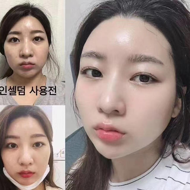 Incellderm インセルダム 3点セット 新品未開封 お買い得の通販 by と