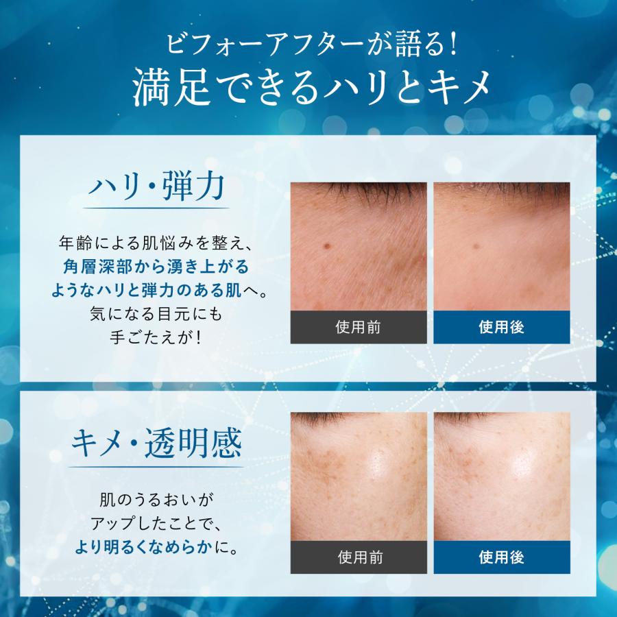 FANCL（ファンケル） コアエフェクター レフィルのみ 美容液