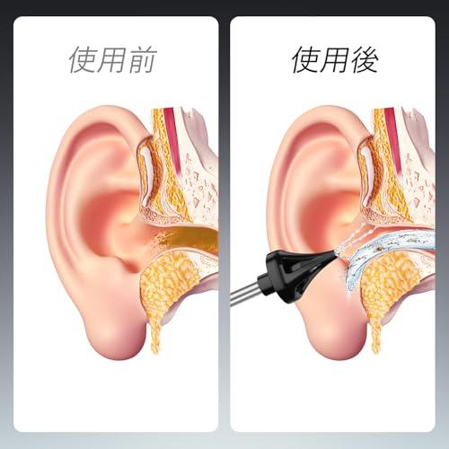 Oralneed 電動耳洗浄器 4種類水流モード IPX7防水 200ml大容量 3個