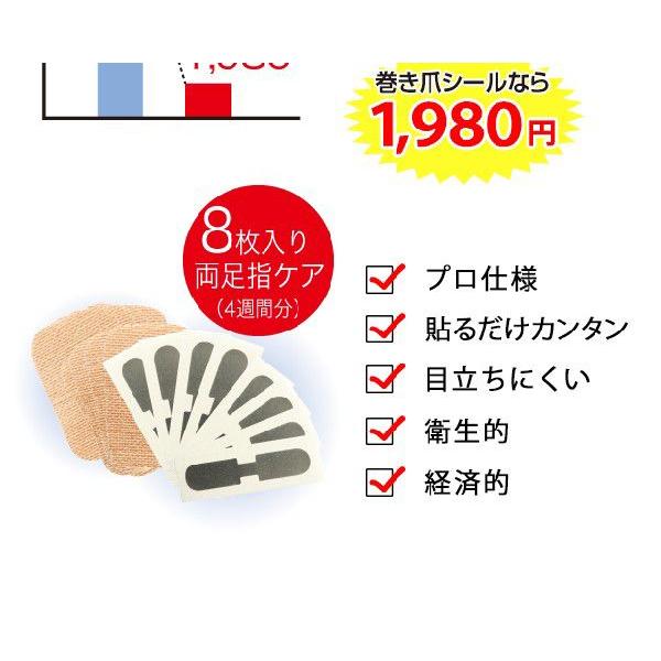 巻き爪 ブロック テープ ワイヤー 巻き爪シール 1ヶ月ケア ネコポス