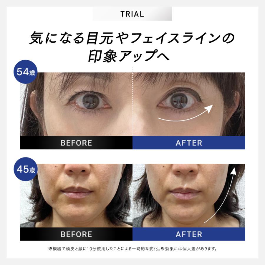 MYTREX（マイトレックス） 「30日間返品保証」美顔器 EMS MYTREX 公式