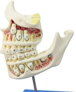 Amazon.co.jp: 歯列模型 乳歯、永久歯、子どもの歯と顎の発達モデル