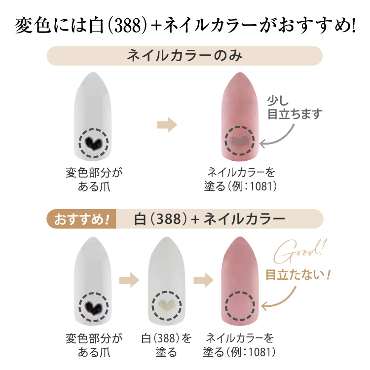 抗がん剤爪変色カバーセット｜ZOYA低刺激ネイル ベース・トップ