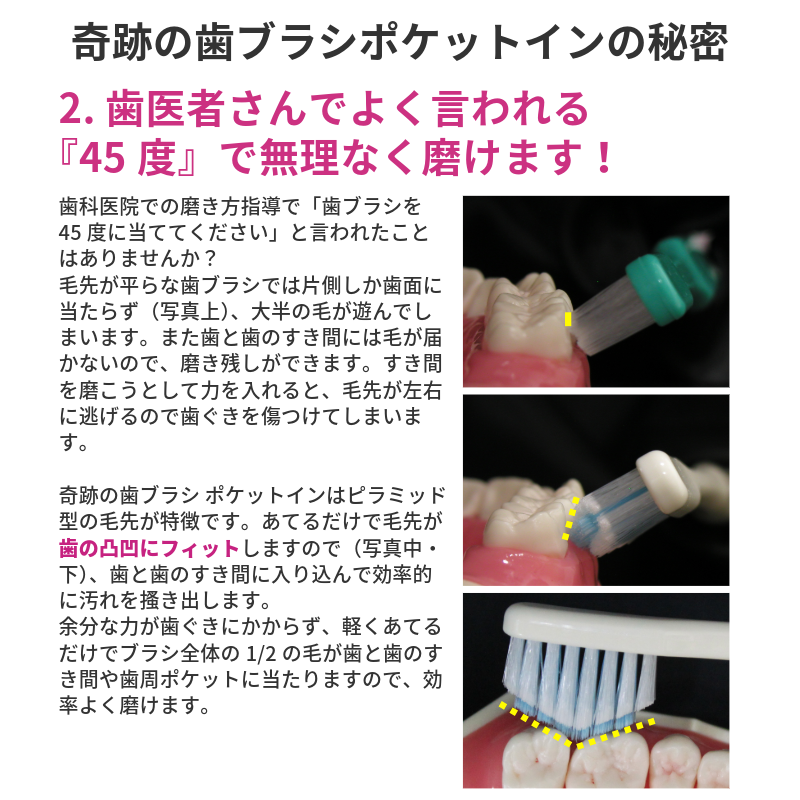 奇跡の歯ブラシ ポケットイン 10本セット 正規品 ピラミッド型 すき間