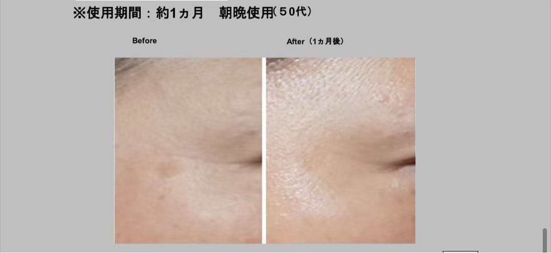 新品ナリスセルグレースフォーミュラI・II セット*3最高峰エイジング